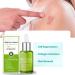 Goopgen Advanced Scar Repair Serum - Nature Scar Treatment for Acne, Surgical Scars, and Stretch Marks (1pcs) - Buy Online on GoSupps.com