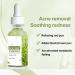 Acne Repair Face Serum Firming Serum For Face Green Tea Hyaluronic Acid Serum Relieve Redness & Acne Natural Face Serum For Acne Day & Night Serum For Face Hydrating Face Oils And Serums-Repair - Buy Online on GoSupps.com