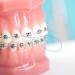DanTicy Floss Threaders for Braces Bridges Implants 200PCS (4Pack) - Blue - Buy Online on GoSupps.com