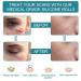 Medical Silicone Scar Tape Roll - 1.6'' x 120'' | Easy-Tear & Reusable | For Surgery, C-section, Keloid, Burns | 6-8 Month Supply - Buy Online on GoSupps.com