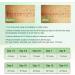 Scar Away Silicone Scar Sheets 1.8 x157 -4M - Medical Grade Tape for Surgical Incisions, C-Section, Keloid, Acne - Painless Scar Removal & Healing Strips - Buy Online on GoSupps.com
