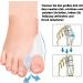 Gel Toe Spreader & Protector (4 Pieces) - Pain Relief for Crooked Hallux Valgus & Overlapping Toes | Toe Cushion & Separator for Comfort - Buy Online on GoSupps.com