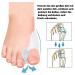 Buy 4X Silicone Hallux Valgus Toe Correction Splint | Toe Spreader & Ball Protection for Pain Relief - Buy Online on GoSupps.com