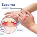 DUBUSH 2023 Eczema Therapy Spray - Natural Relief for Fast Acting Itch Relief and Hydration - 2pcs - Buy Online on GoSupps.com