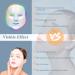 LED Face Mask Light Therapy Anti Acne 7 Color Photonic Mask for Skin Rejuvenation (Beige) - Buy Online on GoSupps.com