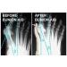 Buy Bale Toe Corrector & Hallux Valgus Spreader - Soft Practical Pain Relief for Men & Women - Fast International Shipping - Buy Online on GoSupps.com