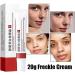 2Pcs Whitening Freckle Cream Acne Scar Removal Treatment Cream Pigmentation Removal Cream for Face Effectively Removes Facial Melasma Dark Spots Blemishes - Buy Online on GoSupps.com