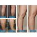 Leg Cramp Cream | 100g Herbal Extract Moisturizing Leg Balm for Sensitive Skin - for Men Women and Adults - Vein Discomfort Prolonged Standing Daily Care - Buy Online on GoSupps.com