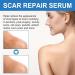 UPGEQMDK Scar Gel Repair A Variety of Scars Acne Marks Skin Care Gel - Buy Online on GoSupps.com