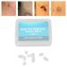 Stem Wart Removal Pack of 30 - Rubber Bands for Skin Tags & Moles (4-8 mm) | Effective Skin Care Tools - Buy Online on GoSupps.com