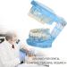 Adult Dental Implant Tooth Model - Blue-Transparent Acrylic for Pedagogical Demonstration | Removable Simulation for Dentists - Buy Online on GoSupps.com