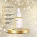 Star Bright Vitamin C Serum | Brightening Face Serum with THD Vitamin C Rosehip & Sea Buckthorn | Even Skin Tone & Reduce Signs of Aging | 1 fl oz - Buy Online on GoSupps.com