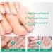 Fungus Treatment Oil Foot Fungus Oil Kerasentials Nail Treatment Healthy Natural Repair Nails Natural Toenail for Damaged & Discolored Toe Nails (2pcs) - Buy Online on GoSupps.com