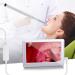 Yannies Ear Wax Removal Tool - 3.9mm HD Otoscope with 6 LED Lights | Ear Wax Removal Endoscope - 4.3 Inch Screen for Children & Adults - Buy Online on GoSupps.com