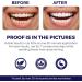DENTELO Teeth Whitening Strips |Zero Sensitivity |Non-Slip Grip |Dentist Formulated Teeth Whitening Kits UK Teeth Whitener Strips Tooth Whitening Strip Teeth Whiteners whitestrips 1 count (Pack of 28) - Buy Online on GoSupps.com