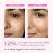 AIN Advanced De-Pigmentation Serum For Hyperpigmentation Melasma Dark Spots & Scars With 2% Kojic Acid | Visibly Brightens & Even Tones Skin | For Women & Men - 30ml - Buy Online on GoSupps.com