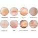 German Advanced Skin Renewal Gel Scar Gel For Acne Scars Stretch Mark Removal Cream Advanced Scar Treatment Natural Scar Therapeuti Gel Scar & Stretch Marks Remover Gel (3pcs) - Buy Online on GoSupps.com