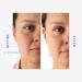 BIOREPUBLIC Organic Soothe & Calm Facial Sheet Mask - Soothing Hydration for All Skin Types | 1.08 FZ - International Shipping Available - Buy Online on GoSupps.com