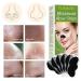 20 Pore Strips for Blackheads - Nosestripes Blackhead Clear-Up Strips for Men & Women - Buy Online on GoSupps.com