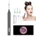 Ear Wax Removal Ear Cleaner with 3MP HD Camera Ear Wax Removal Tool 1080P Otoscope with Light - Ear Cleaning for iOS & Android (Black)