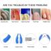 Super Cuticle Nippers Hangnail Remover Cuticle Cutter Sharpener Cuticle Trimmer for Fingernails Pedicure Manicure Toenails(blue) - Buy Online on GoSupps.com