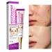 Dark Spot Remover for Face Nicotinamide Whitening Freckle Cream Skin Dullness Lightening Body Cream Visible Results in 28 Days Smooth Melasma Hyperpigmentation Age Dark Spot Corrector 0.7 oz