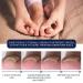 German ToenailPlus Anti Paronychia Relief Oil - Repair Damaged Nails (2 Pcs) - Buy Online on GoSupps.com