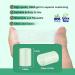 Buy Big Toe Protectors (10pcs) - Gel Toe Caps & Open Toe Sleeves for Blisters Corns Hammer Toes & Toenail Loss - Breathable & Aloe Vera Infused - Buy Online on GoSupps.com