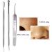 Acne Needle Needle Tool Face Cleaning Blackheads Acne Removal Comedone Extractor Black Head Blemish Pimple Remover Tool Pore Cleaner (Color : 5pcs Style 1) - Buy Online on GoSupps.com