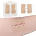 Emergency Waterproof Wound Closure Strips Butterfly Bandages Stitch Sutures Adhesive Bandages for First Aid Zipper Laceration Repair Without Stitches for Wound Care 2 Pieces-2.17*1.97 "
