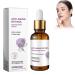 Essence anti- ge au r tinol - S rum de r g n ration du visage - Essence anti-rides naturelle anti-rides - Essence de r tinol anti-rides pour une peau clatante et pour r duire l'acn