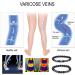 juyt Anti Varicose & Swelling Anklet 4pcs Anti-Swelling Black Obsidian Slimming Hematite Bracelet Magnetic Therapy Ankle Bracelet Adjustable Anklet for Relieve Veins and Weight Loss (C) - Buy Online on GoSupps.com