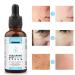 Hyaluronic Acid Serum 2-Pack - Anti-Aging Moisturizing Wrinkle Serum | Erase Fine Lines, Hydrate, and Soften Skin | Easy Absorption Formula | 1 Fl Oz (Pack of 2) - Buy Online on GoSupps.com