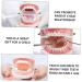 Ultechnovo Dental Model Set - Educational Children's Tooth Model | Plastic Denture Model for Kids | Ideal for Schools & Dental Training - Buy Online on GoSupps.com