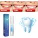 LANTHOME Teeth Whitening Essence - 3Pcs Teeth Stain Remover Kit for Pure White Teeth - Buy Online on GoSupps.com