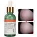 Scar Prevention & Stretch Mark Repair Essential Oil - Premium Beauty Solution for Women | Shop Now! - Buy Online on GoSupps.com