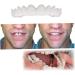 Pastoralist 2 Pairs Dentures Cosmetic Teeth Instant Veneers Temporary Teeth and Bottom Dentures Fit Comfort - Buy Online on GoSupps.com