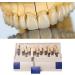 29 Color Porcelain Tooth Whitening Color Keys - Removable Tooth Elevation Table for Accurate Shade Matching - Buy Online on GoSupps.com
