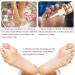 15ml Corn and Wart Remover Liquid for Feet - Callus and Cuticle Removal Treatment - Buy Online on GoSupps.com