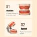 Dental Teeth Model B-28 with Soft Gums & Removable Teeth - Ideal Teaching Aid for Dentists | International Shipping - Buy Online on GoSupps.com