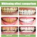 Ampoule Toothpaste & Serum - 3V Fruit Acid Tooth Whitening Essence | International Shipping Available - Buy Online on GoSupps.com