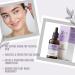 Organic Niacinamide Serum for Face - Brighten & Hydrate | Anti-Wrinkle Natural Moisturizer - Buy Online on GoSupps.com