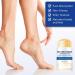  SONGVISON Urea Foot Cream 60% 2025 New Foot Cream for Cracked Heel and Dry Skin Urea Lotion for Deep Hydration Remove Callos Nourish Soften 40g - Buy Online on GoSupps.com