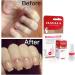 Mavala Stop Deterrent Nail Polish Treatment Stops Putting Fingers In Your Mouth For Ages 3+ 5 ml (Pack of 1) - Buy Online on GoSupps.com