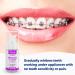 OrthoFoam Braces Cleaner - Foaming Bubbles Whiten Teeth, Fight Plaque - 25ml - Buy Online on GoSupps.com