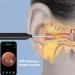 Rememower Otoscope 1080p HD Ear Wax Removal Tool - Waterproof Ear Cleaner for iPhone iPad & Android - Ultrad nne Design with 3.5mm Lens & U6 LEDs - Glossy Black - Buy Online on GoSupps.com