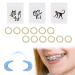 Dental orthodontic latex elastics dental elastic tea rubber band toothed gum pull tapes orthodontic latex elastics elastic braces gum teeth rubber band dental C-shape mouth opener 300PCs