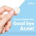 Micro Spot Care Patch - Self-Dissolving Acne Pimple Treatment | Target Zits & Blemishes with Patented 17mm Microdart Technology - Buy Online on GoSupps.com