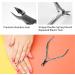Lofuanna Cuticle Nippers and Pusher Set - Professional Stainless Steel Manicure Tools for Dead Skin Fingernails and Toenails (Black) - Buy Online on GoSupps.com