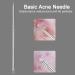 Rnitle Blackhead Remover Set - Stainless Steel Comedone Squeezer for Acne & Whiteheads - Effective Blackhead Removal for All Skin Types - Buy Online on GoSupps.com